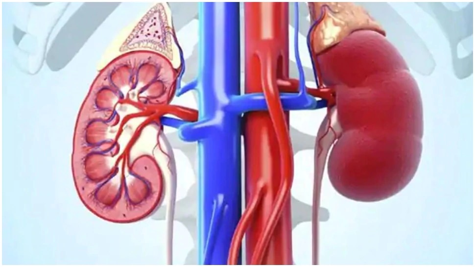 Healthy Kidney: Five reasons for kidney stone | Healthy Kidney : ಕಿಡ್ನಿ ಸ್ಟೋನ್ ಗೆ ಕಾರಣವಾಗುವ ಈ ಐದು ತಪ್ಪು ಮಾಡಲೇಬೇಡಿ.! Health News in Kannada