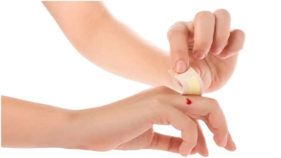 Vitamin C Deficiency Symptoms Dont ignore these symptomes Vitamin C