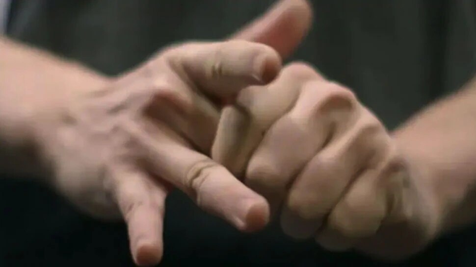 Cracking Knuckles side effects of cracking fingers joint pain may