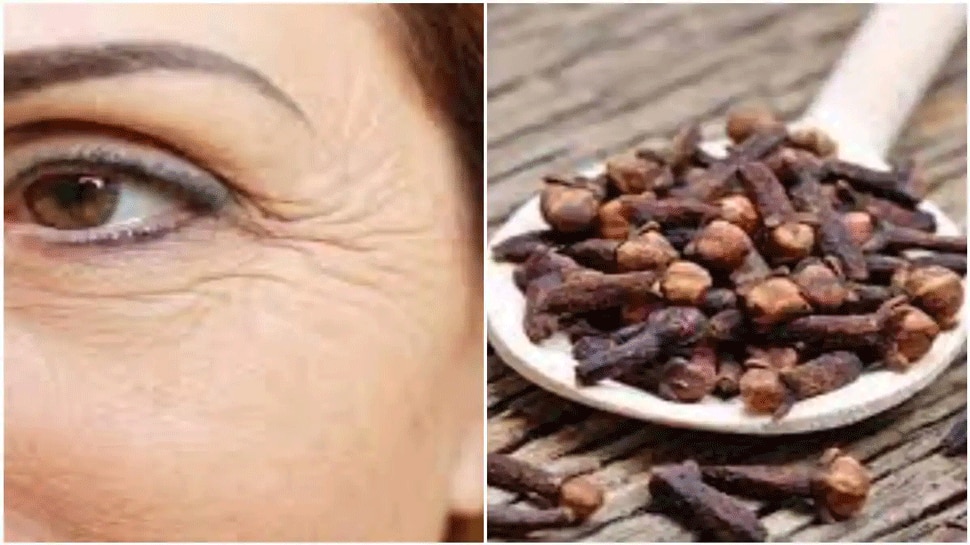 Let us know how to use cloves to remove wrinkles ಸುಕ್ಕುಗಳನ್ನು