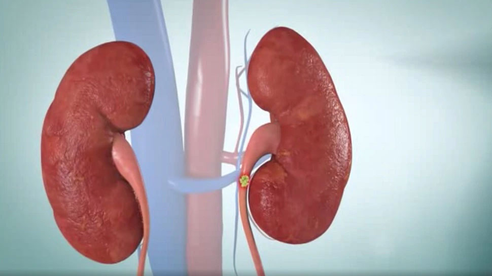 kidney-failure-these-5-habits-spoil-the-kidneys-these-symptoms-are