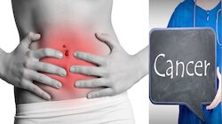 Ovarian Cancer: ಈ ಸಣ್ಣ ರೋಗಲಕ್ಷಣಗಳನ್ನು ಎಂದೂ ಸಹ ನಿರ್ಲಕ್ಷಿಸಬೇಡಿ, ಅದು ಕ್ಯಾನ್ಸರ್ ಆಗಿರಬಹುದು!