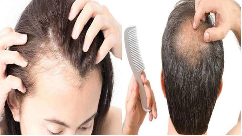 Hair Fall Treatment: Hair will never fall, just keep this one thing in