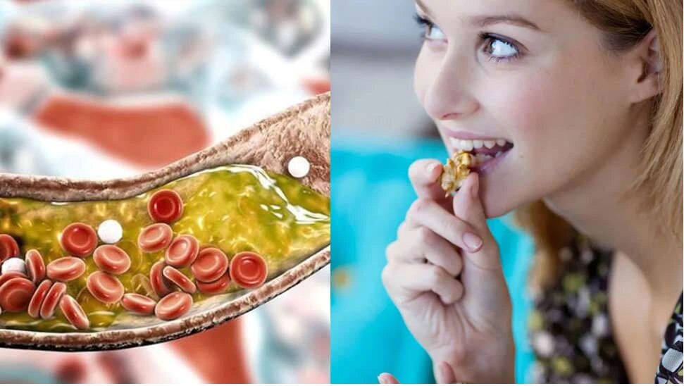 Health Tips: ಈ ಡ್ರೈ ಫ್ರೂಟ್ ಕೊಲೆಸ್ಟ್ರಾಲ್ ಮಟ್ಟವನ್ನು ಕಡಿಮೆ ಮಾಡುತ್ತದೆ!  