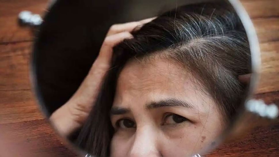 White Hair Problem: ಬಿಳಿ ಕೂದಲಿನ ಸಮಸ್ಯೆಗೆ ಸರಳ ಮನೆಮದ್ದು 