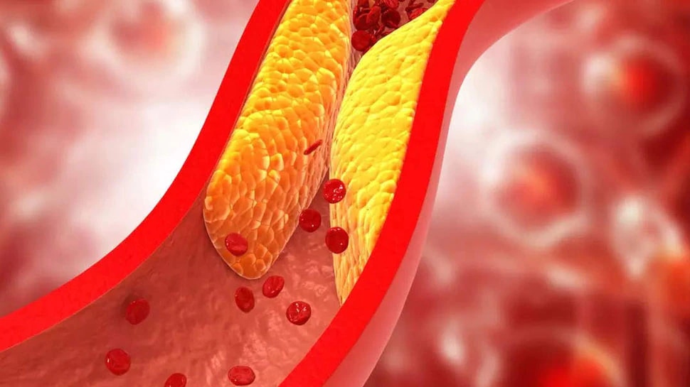 cholesterol-high-cholesterol-warning-signs-never-ignore-chest-pain