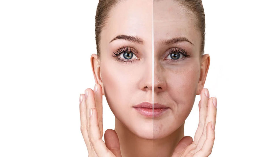 Apply a few drops of Almond Oil on the face before sleeping know its