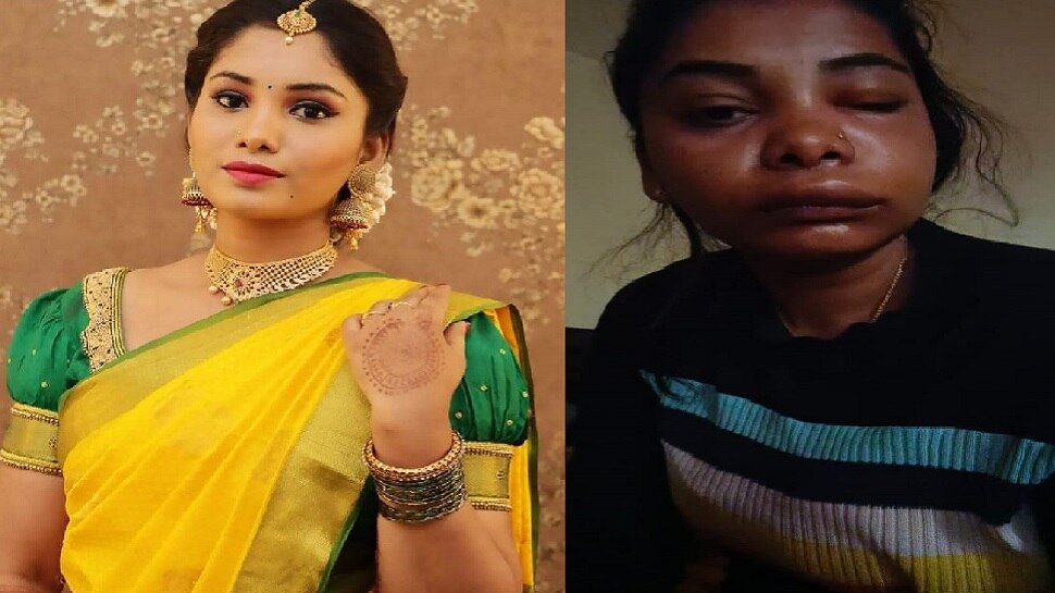 Kannada Actress Swathi Sathish Root Canal Surgery Goes Wrong, Suffers