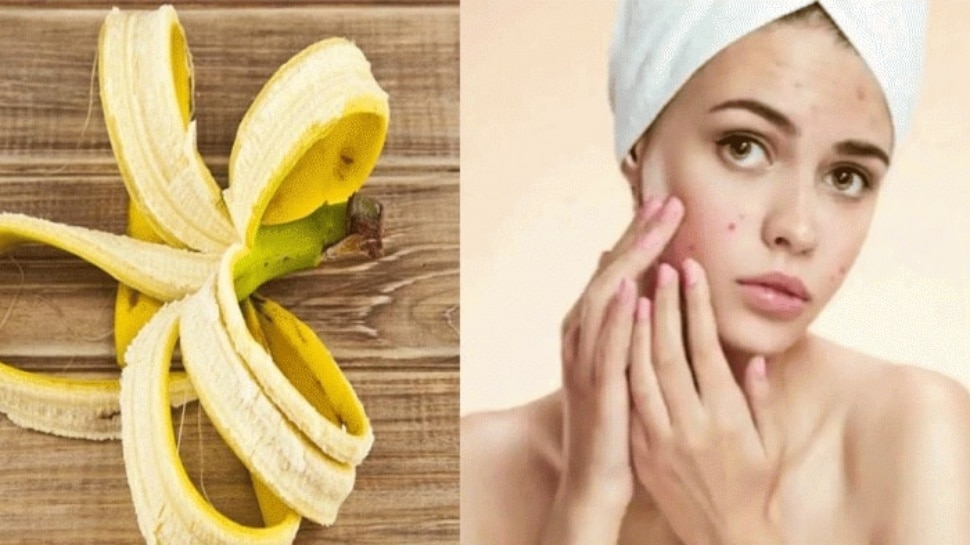 Banana peel for skin and hair care ಚರ್ಮದ ಆರೈಕೆಗೆ ಬಾಳೆಹಣ್ಣಿನ ಸಿಪ್ಪೆ