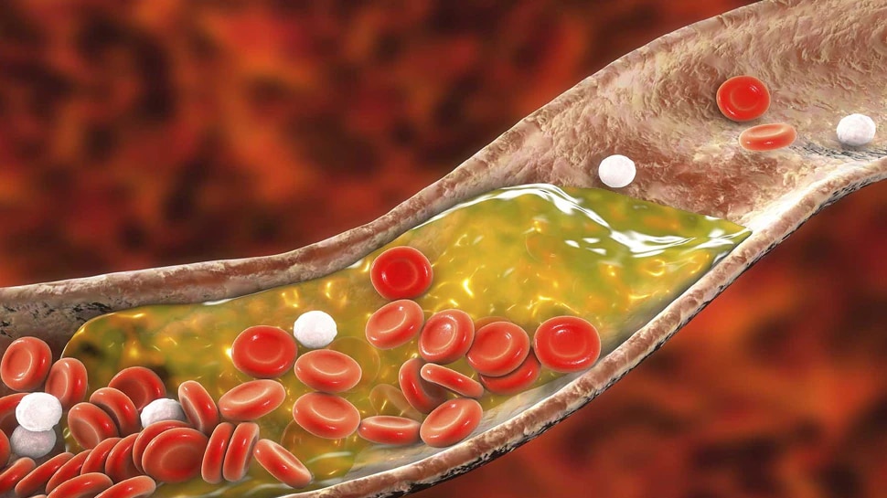 Health Tips: High Cholesterol will be eradicated, just eat these 2