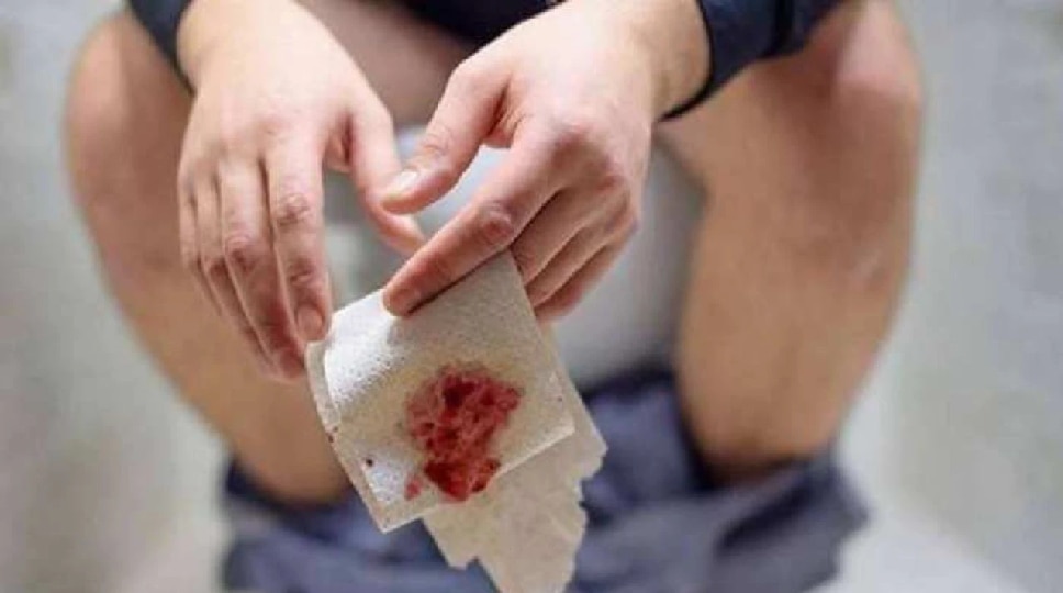 Health Tips No medicine and Surgery, These home remedies will get rid