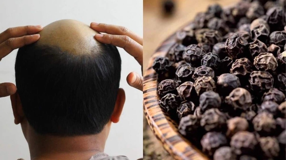 Black pepper is the solution for baldness ಬೋಳು ತಲೆ ಸಮಸ್ಯೆಗೆ ಕರಿಮೆಣಸಿನಲ್ಲಿದೆ ಪರಿಹಾರ Health News