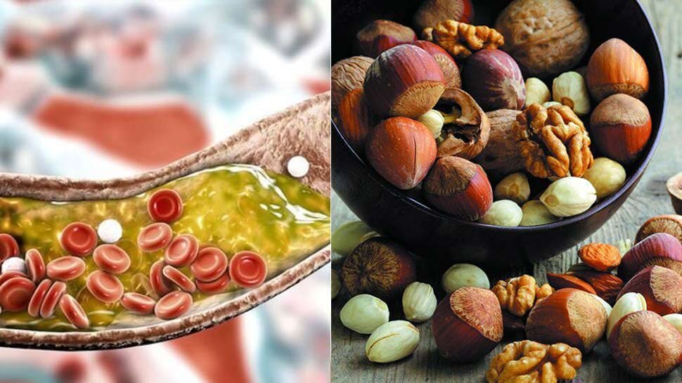 dry fruits for reducing bad cholesterol in blood pistachio almonds