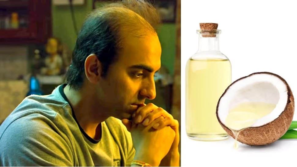 coconut oil benefits to avoid hair fall baldness hair care tips ಕೂದಲು ಉದುರುವ ಸಮಸ್ಯೆಗೆ ಇಲ್ಲಿದೆ
