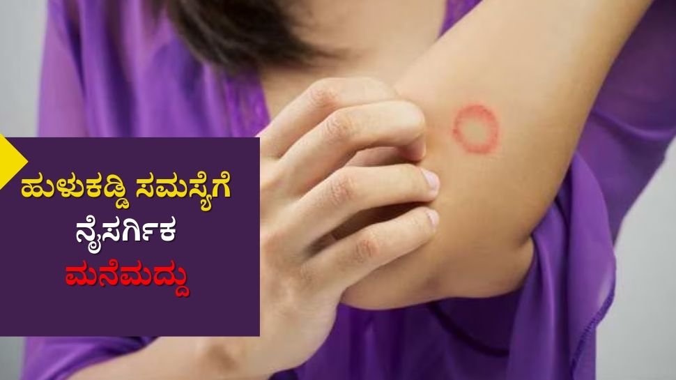 Home remedies for itching, ringworm, fungal infection problem ತುರಿಕೆ, ಹುಳಕಡ್ಡಿ, ಫಂಗಲ್