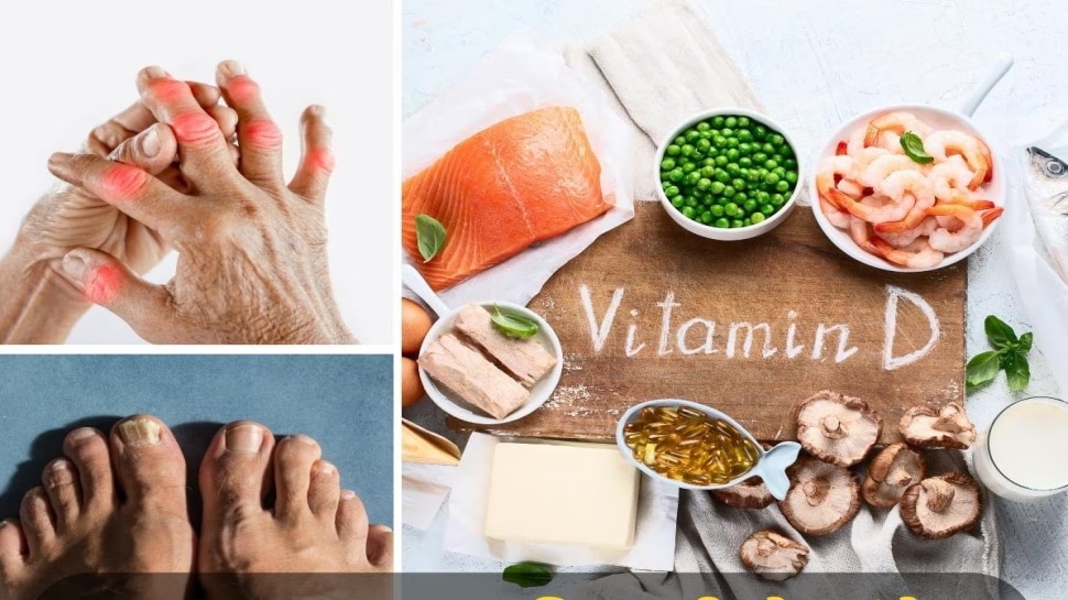 vitamin d defeciancy symptoms ದೇಹದಲ್ಲಿ ವಿಟಮಿನ್ ಡಿ ಕೊರತೆಯಾದರೆ