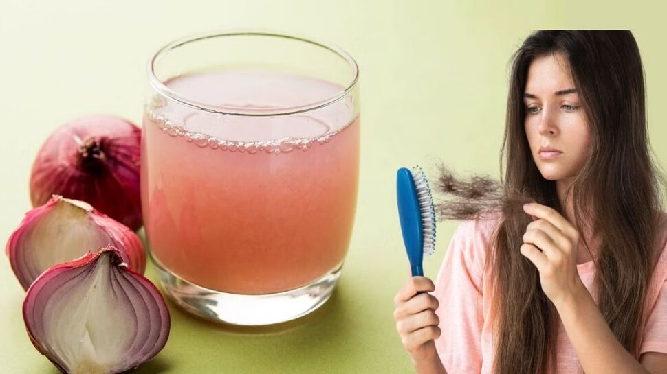 onion juice benefits to regrow hair ಬೋಳು ತಲೆ ಸಮಸ್ಯೆಯನ್ನು ನೈಸರ್ಗಿಕವಾಗಿ