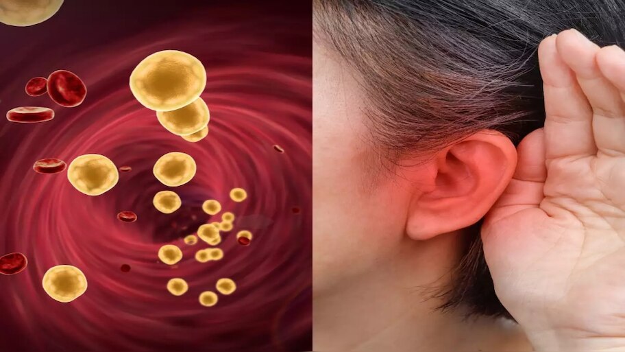 high cholesterol effect on hearing |ಕೊಲೆಸ್ಟ್ರಾಲ್ ಹೆಚ್ಚಾದಾಗ ಪರಿಣಾಮ ಹೃದಯ ...
