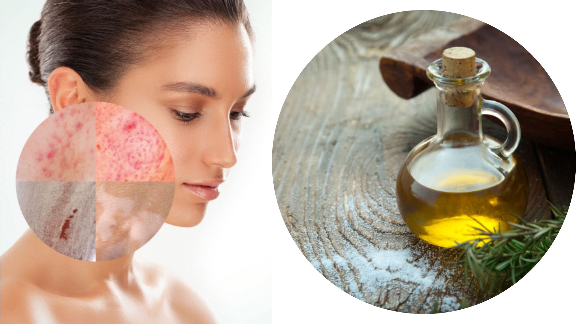Benefits Of Castor Oil to skin ತ್ಚಚೆಯ ಎಲ್ಲಾ ಸಮಸ್ಯೆಗಳಿಗೆ ಸೂಕ್ತ ಈ ಎಣ್ಣೆ.. ಟ್ರೈ ಮಾಡಿ ನೋಡಿNews in
