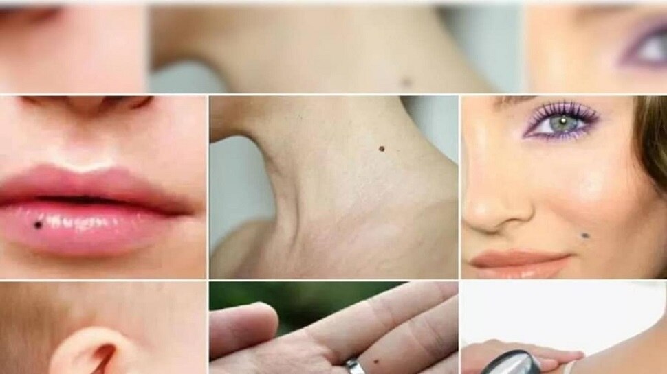 lucky-people-have-moles-on-these-places-of-their-body-suddenly-they