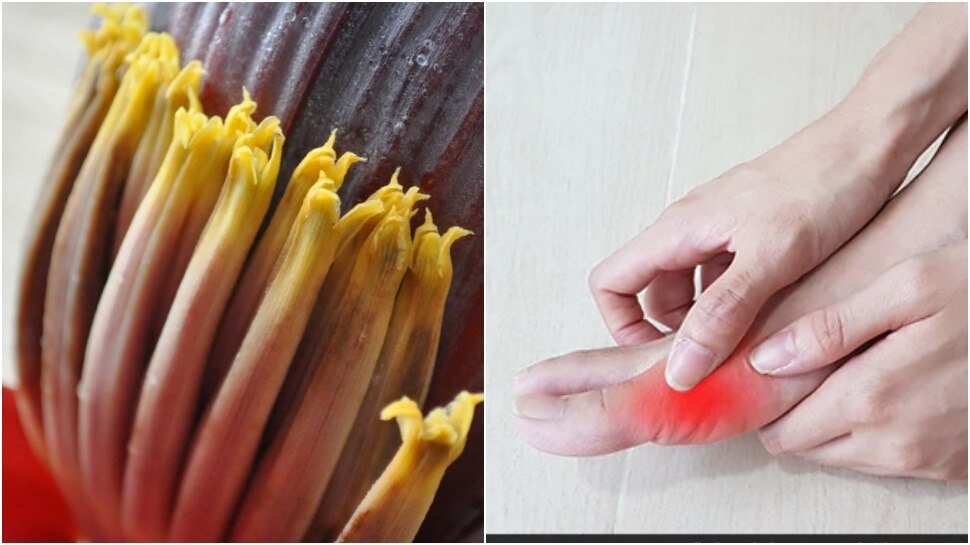 Banana flowers for uric acid and kidney stone ಈ ಹೂವನ್ನು ತಿಂದರೆ ಯೂರಿಕ್
