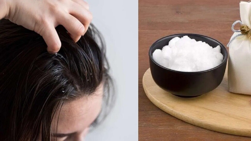 Applying camphor and coconut oil cures problems like dandruff split