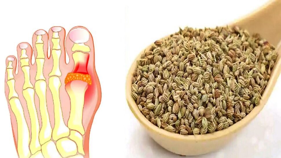 ajwain water to control uric acid ಅಜ್ವೈನ್ ನೀರು ಕುಡಿದರೆ ಯುರಿಕ್ ಆಸಿಡ್