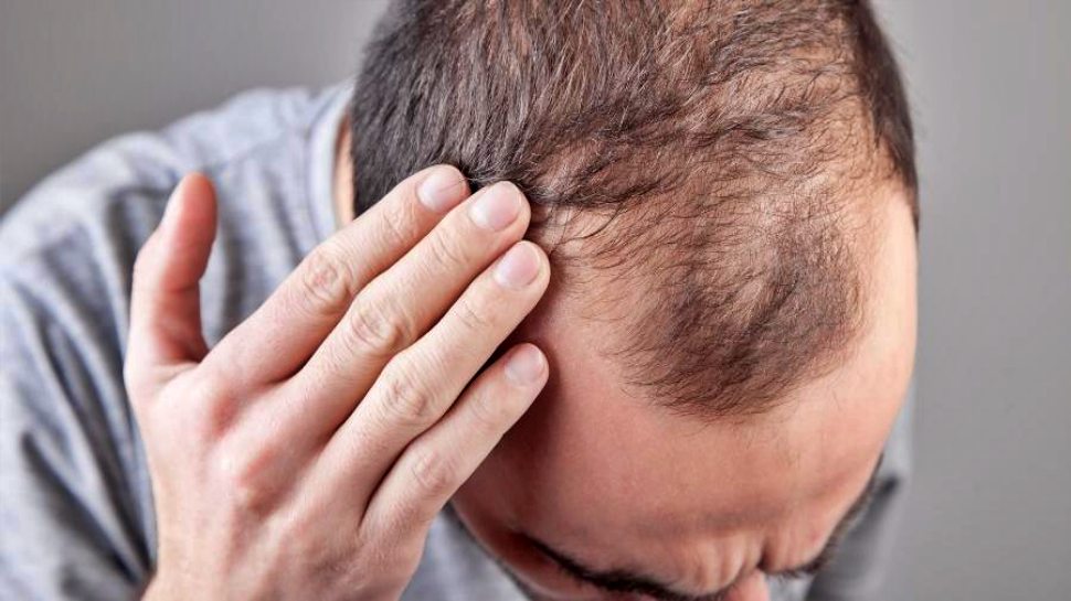 Neem Oil remedies for Hair Fall Control | ಕೂದಲು ಉದುರುವಿಕೆ ಮನೆ ಮದ್ದು ...