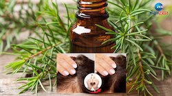 Hair Care: ಕೂದಲಿನ ಹಲವು ಸಮಸ್ಯೆಗಳಿಗೆ ಈ ಎಣ್ಣೆಯೊಂದೇ ಪರಿಹಾರ 