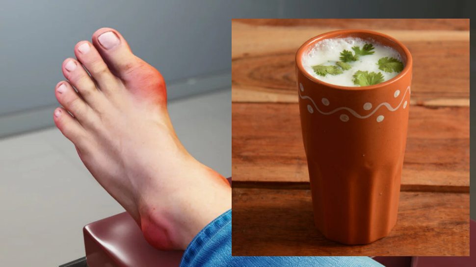 coriander leaves buttermilk benefits to control uric acid ಯುರಿಕ್