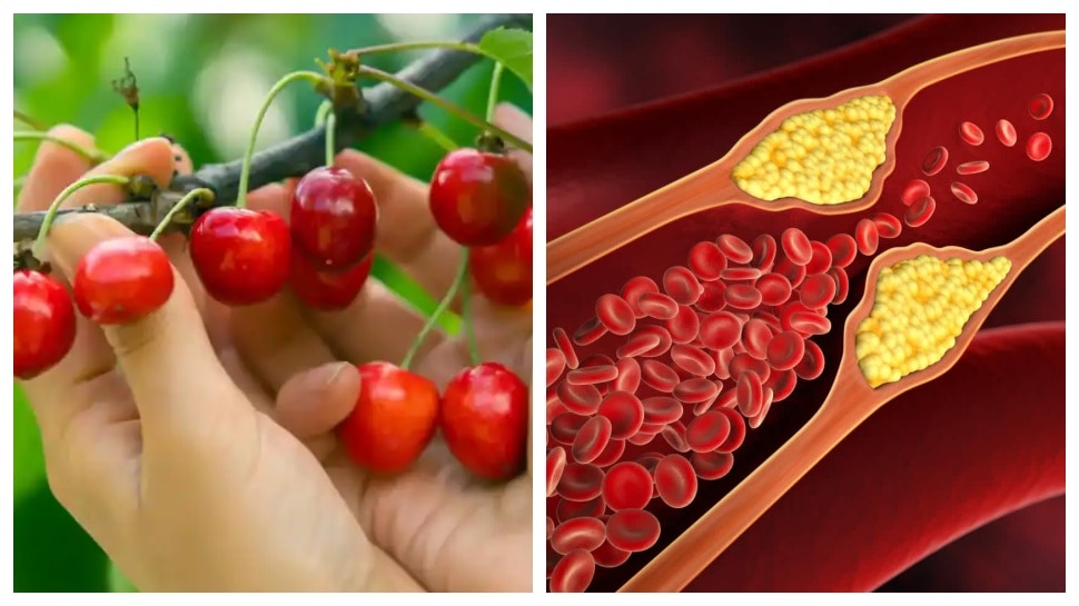 health benefits of cheery fruit ಚೆರ್ರಿ ಹಣ್ಣಿನ ಆರೋಗ್ಯ ಪ್ರಯೋಜನಗಳು Health