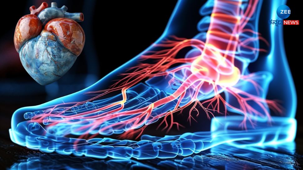 Unusual Signs Of High Cholesterol Heart Blockage In Men 