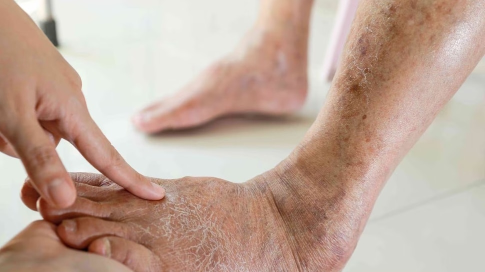 Don't make the mistake of ignoring tingling and swelling in your feet