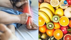Uric Acid Remedy: ನೈಸರ್ಗಿಕವಾಗಿ ಯೂರಿಕ್ ಆಸಿಡ್ ನಿಯಂತ್ರಣಕ್ಕೆ ಲಾಭದಾಯಕ ಹಣ್ಣುಗಳು 