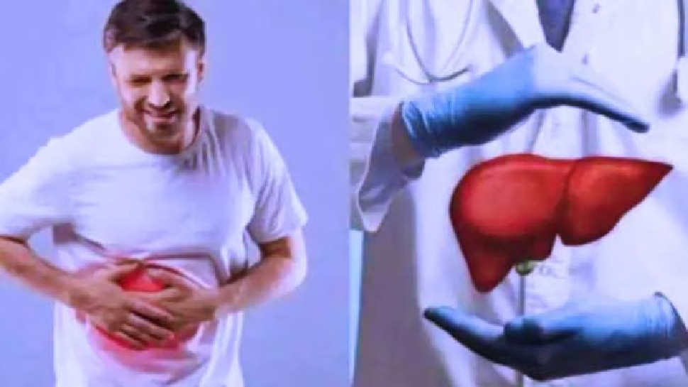 Fatty Liver: ಫ್ಯಾಟಿ ಲಿವರ್ ಎಂದರೇನು? ಕಾರಣಗಳು, ಲಕ್ಷಣಗಳು & ಚಿಕಿತ್ಸೆ
