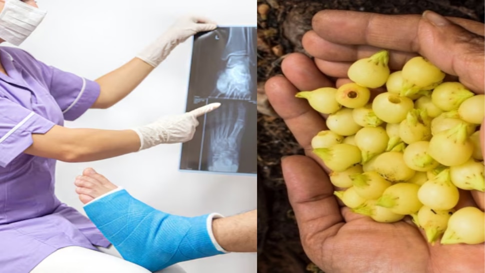 ಮೂಳೆ ಮುರಿತಕ್ಕೊಳಗಾದರೆ ಬ್ಯಾಂಡೇಜ್ ಹಾಕಿ ಕೂರಬೇಕಿಲ್ಲ!ಈ ಹಣ್ಣನ್ನು ಹಾಲಿನೊಂದಿಗೆ ನಿತ್ಯ ಸೇವಿಸಿ ನೋಡಿ !