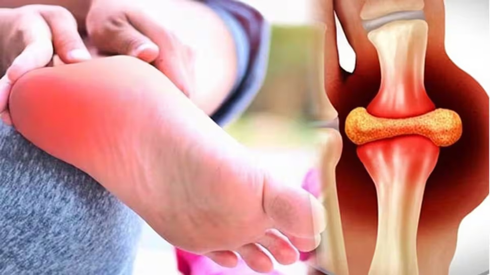  ಯೂರಿಕ್ ಆಮ್ಲದ ಬಗ್ಗೆ ಚಿಂತಿಸುತ್ತಿದ್ದೀರಾ? ಹಾಗಿದ್ದರೆ ಈ 5 ಕಾಳುಗಳನ್ನು ತಿನ್ನುವುದನ್ನು ಬಿಡಿ 