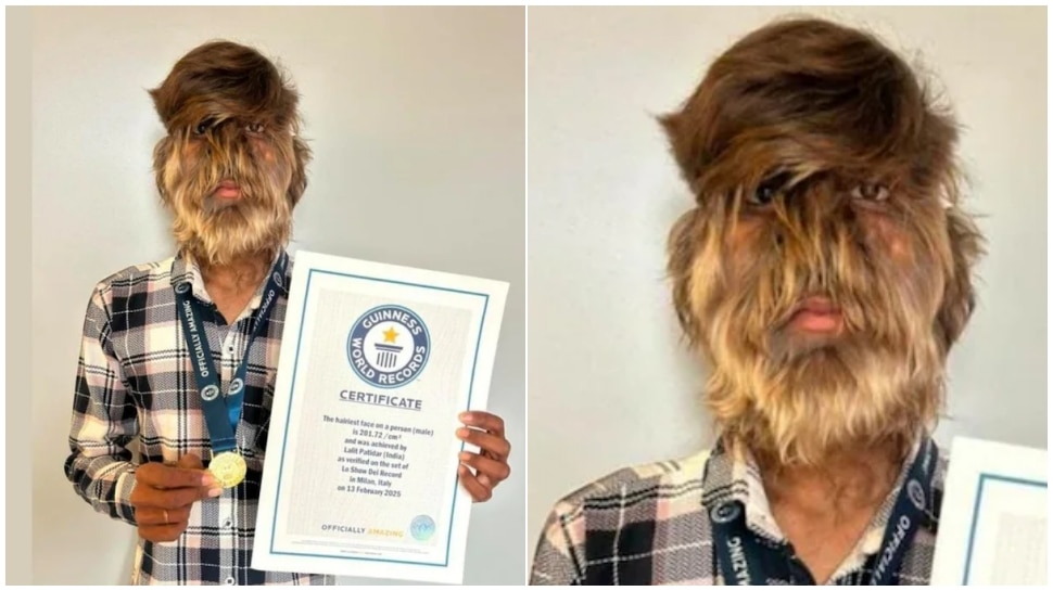 ವಿಶ್ವ ದಾಖಲೆ ಸೃಷ್ಟಿಸಿದ "ತೋಳ ಮಾನವ"..! ಪ್ರಾಣಿಯಂತಿರುವ ಈ ಯುವಕನ ಹಿನ್ನೆಲೆ ಕೇಳಿದ್ರೆ ಬೆಚ್ಚಿ ಬೀಳ್ತಿರಾ..