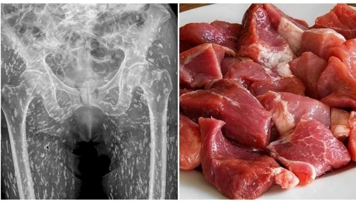 ಮಾಂಸ ಪ್ರಿಯರೇ ಎಚ್ಚರ..! ಈ ಪ್ರಾಣಿಯ ಮಾಂಸ ತಿಂದರೆ ನಿಮ್ಮ ಪ್ರಾಣವೇ ಹಾರಿ ಹೋಗುತ್ತೆ.. ಅದರಲ್ಲೂ ಹೀಗೆ ತಿನ್ನಲೇಬಾರದು