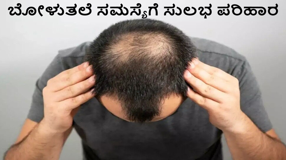 ಕೂದಲು ಅತಿಯಾಗಿ ಉದುರಲು ದೇಹದಲ್ಲಿ ಈ ವಿಟಮಿನ್‌ ಕೊರತೆಯೇ ಕಾರಣ..! ಈ ಸಮಸ್ಯೆಗೆ ಶಾಶ್ವತ ಪರಿಹಾರ ಪಡೆಯಲು ಇಲ್ಲಿದೆ ಸುಲಭ ಟಿಪ್ಸ್