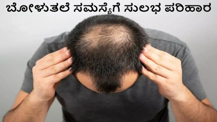 ಕೂದಲು ಅತಿಯಾಗಿ ಉದುರಲು ದೇಹದಲ್ಲಿ ಈ ವಿಟಮಿನ್‌ ಕೊರತೆಯೇ ಕಾರಣ..! ಈ ಸಮಸ್ಯೆಗೆ ಶಾಶ್ವತ ಪರಿಹಾರ ಪಡೆಯಲು ಇಲ್ಲಿದೆ ಸುಲಭ ಟಿಪ್ಸ್