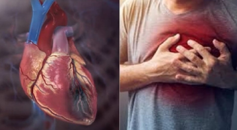 Heart Attack: ಈ ಒಂದೇ ಒಂದು ಟೆಸ್ಟ್ನಿಂದ ಹೃದ್ರೋಗಗಳನ್ನು ಮೊದಲೇ ಪತ್ತೆ ಹಚ್ಚಬಹುದು Heart Attack: ಈ ಒಂದೇ ಒಂದು ಟೆಸ್ಟ್ನಿಂದ ಹೃದ್ರೋಗಗಳನ್ನು ಮೊದಲೇ ಪತ್ತೆ ಹಚ್ಚಬಹುದು