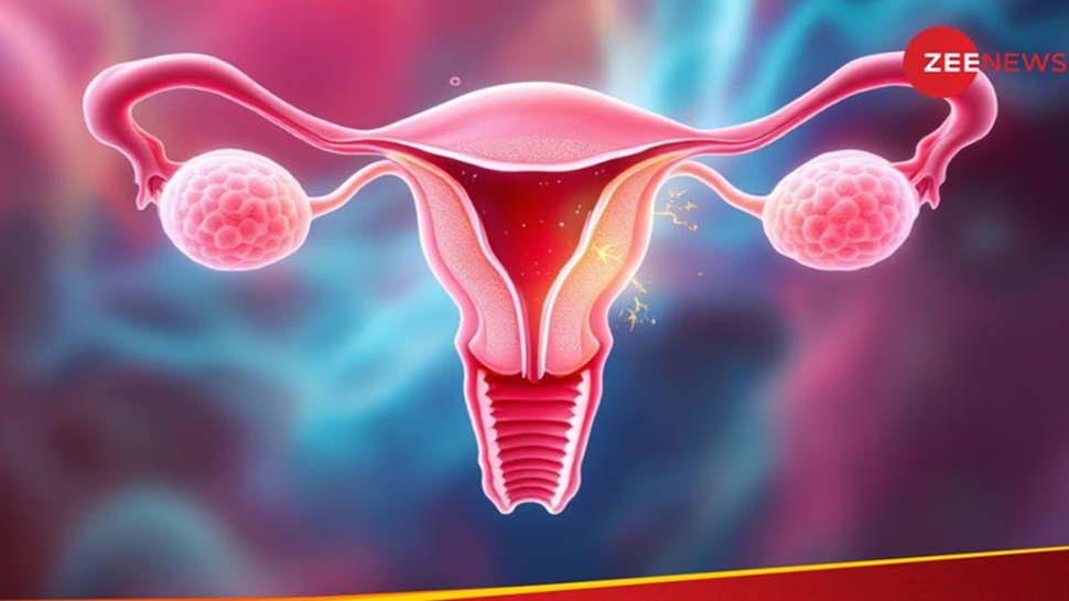 ಗರ್ಭಾಶಯದ ಉರಿಯೂತ: ಲಕ್ಷಣಗಳು ಮತ್ತು ಗಮನಿಸಬೇಕಾದ ಸಂಗತಿಗಳು