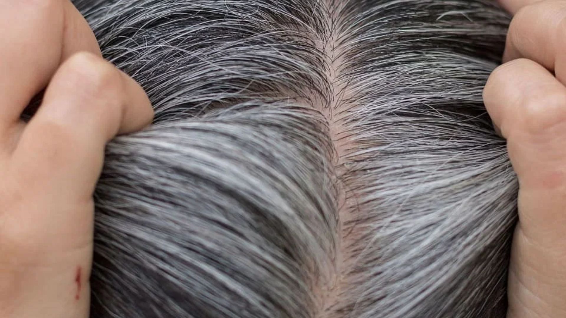Say Goodbye to Hair Dye: This miraculous leaf and castor oil will black to black in minutes, that too forever! 33 516791 White Hair 14