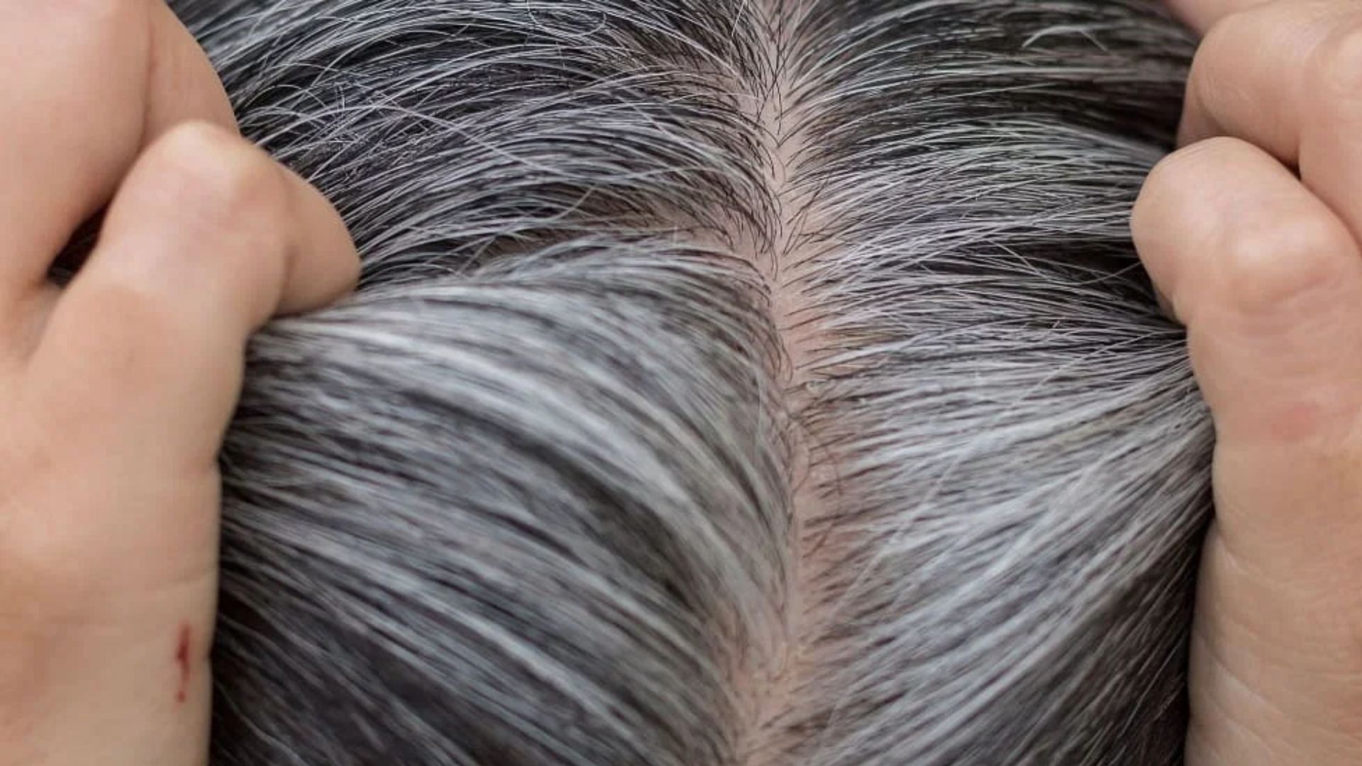 Say Goodbye to Hair Dye: This miraculous leaf and castor oil will black to black in minutes, that too forever! 32 516792 White Hair 9