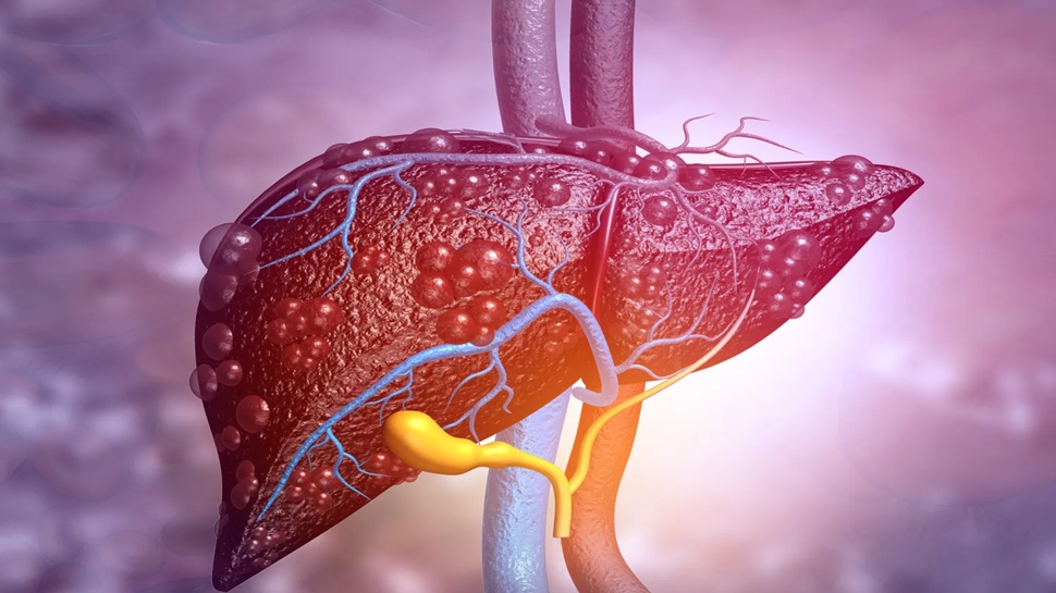 Fatty Liver: ಪ್ರತಿನಿತ್ಯ ಚಿಟಿಕೆಯಷ್ಟು ʻಈʼ ಪುಡಿಯನ್ನು ಬಾಯಿಗೆ ಹಾಕಿಕೊಂಡರೆ, ಯಾವುದೇ ಔಷಧಿ ಇಲ್ಲದೆ ಕಾಣೆಯಾಗುತ್ತೆ ಕೊಬ್ಬಿದ ಯಕೃತ್ತಿನ ಸಮಸ್ಯೆ! Fatty Liver: ಪ್ರತಿನಿತ್ಯ ಚಿಟಿಕೆಯಷ್ಟು ʻಈʼ ಪುಡಿಯನ್ನು ಬಾಯಿಗೆ ಹಾಕಿಕೊಂಡರೆ, ಯಾವುದೇ ಔಷಧಿ ಇಲ್ಲದೆ ಕಾಣೆಯಾಗುತ್ತೆ ಕೊಬ್ಬಿದ ಯಕೃತ್ತಿನ ಸಮಸ್ಯೆ!