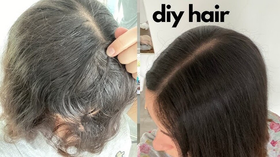 home remedies for white hair