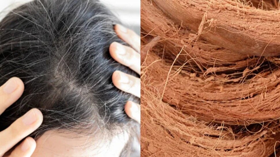 home remedies for white hair