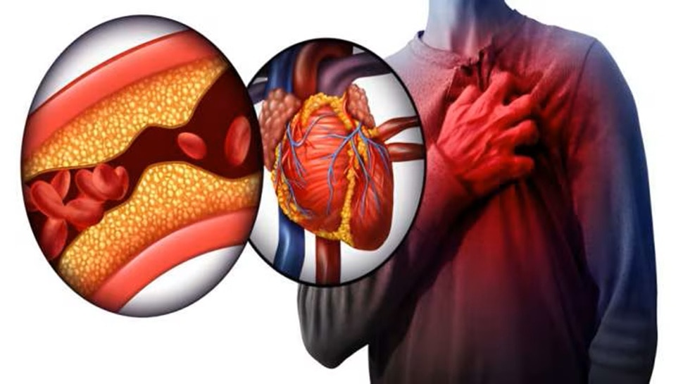 Heart Attack First Aid in Kannada