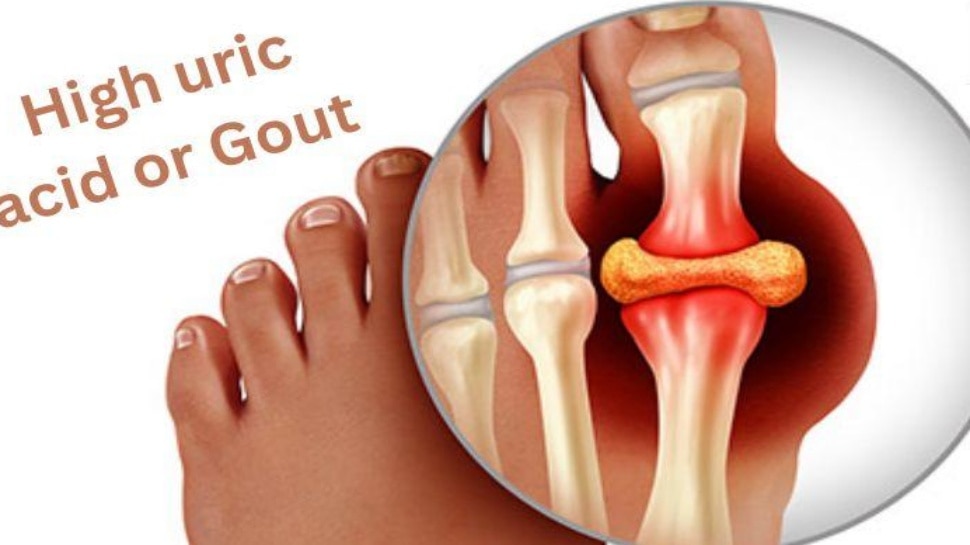 Fruit to flush out uric acid 